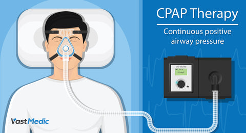 Are CPAP Cleaning Machines Worth It?